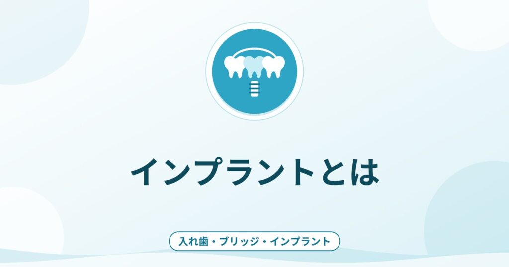 インプラントとは|仕組み・利点・リスクと治療の流れ