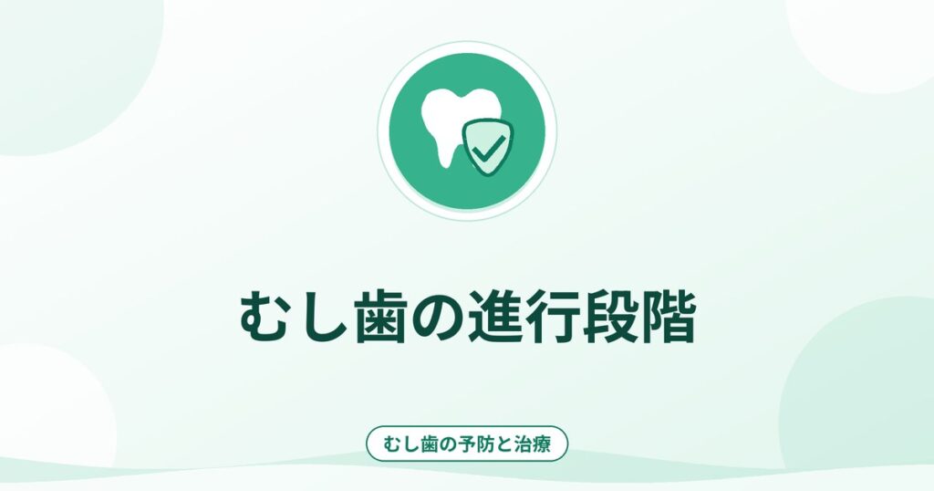 むし歯の進行段階|C0〜C4の見方と治療の考え方